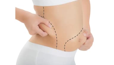 CoolSculpting Pioneers: How LIFE Brought Fat-Freezing to India in 2012 β LIFE Journal article