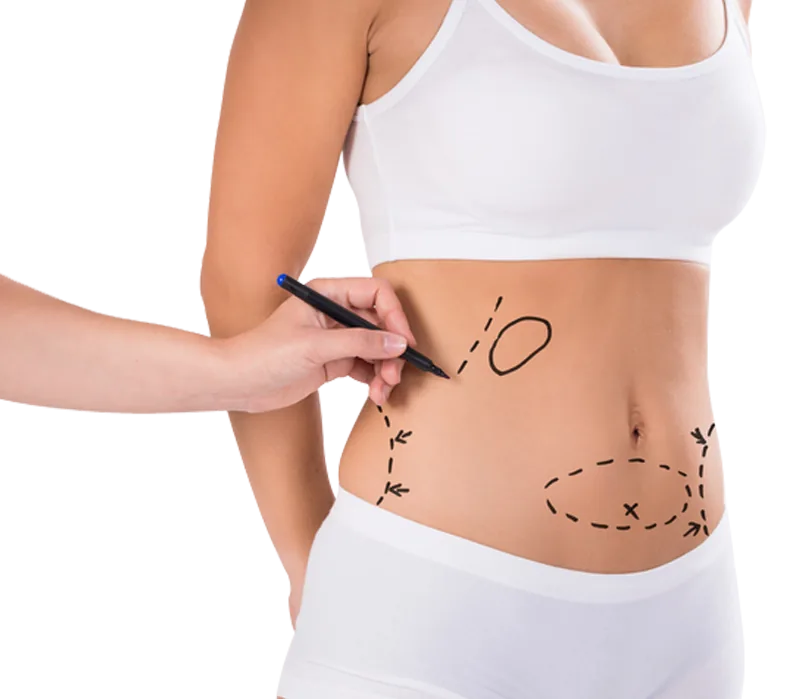 Original LIFE image showing body-contouring area mapping